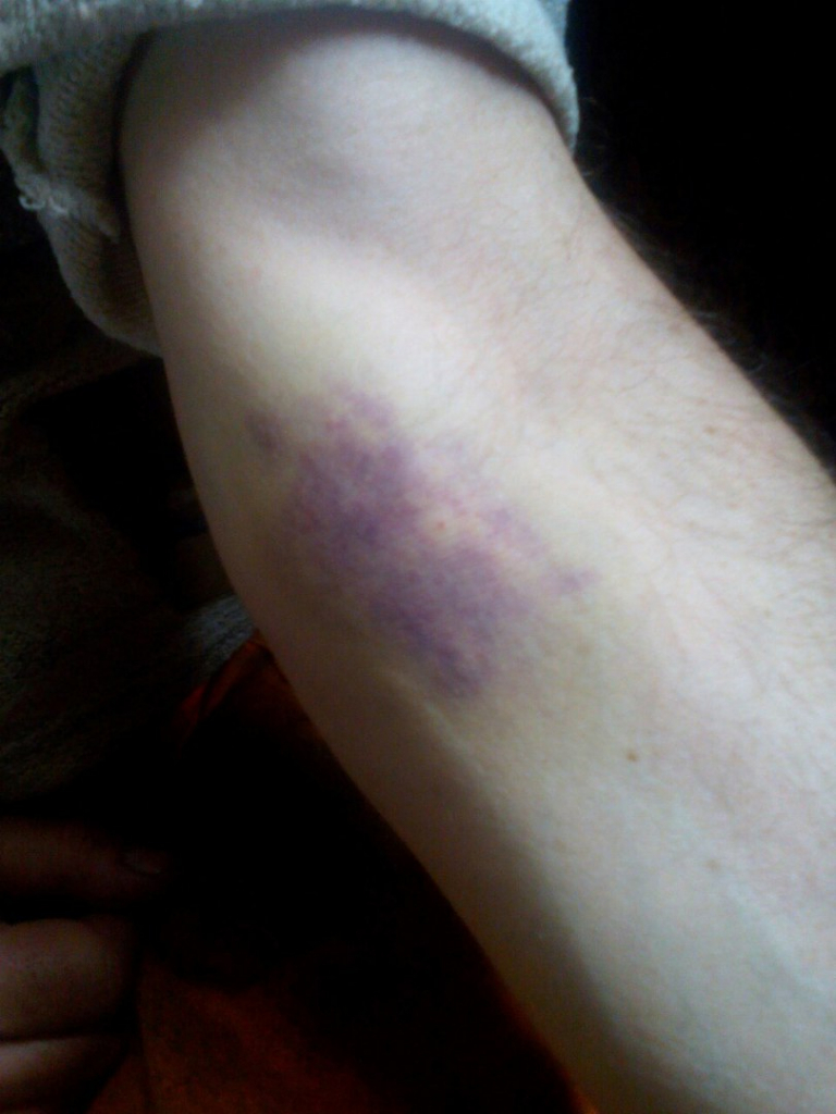 Изображение к жалобе