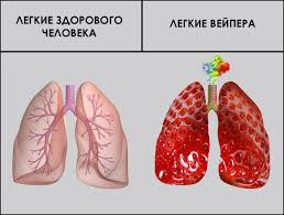 Изображение к жалобе