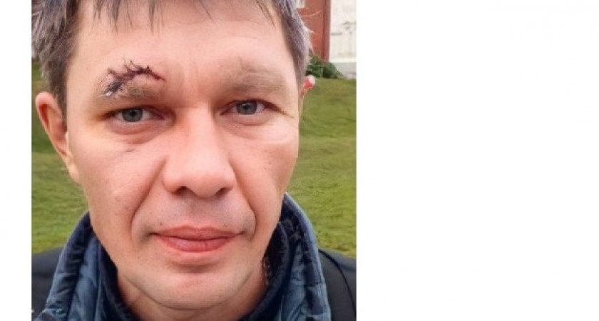 Уже более 3 недель поисковики ищут владимирца со шрамом