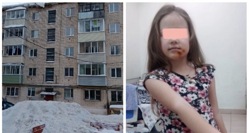 5-летняя девочка порвала губу, скатившись с наваленной коммунальщиками горы снега