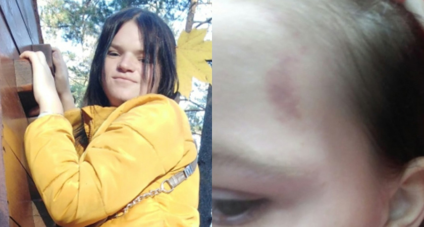 «С ноги в живот ударила, потом в грудь»: в Коврове избили девушку и сняли на видео