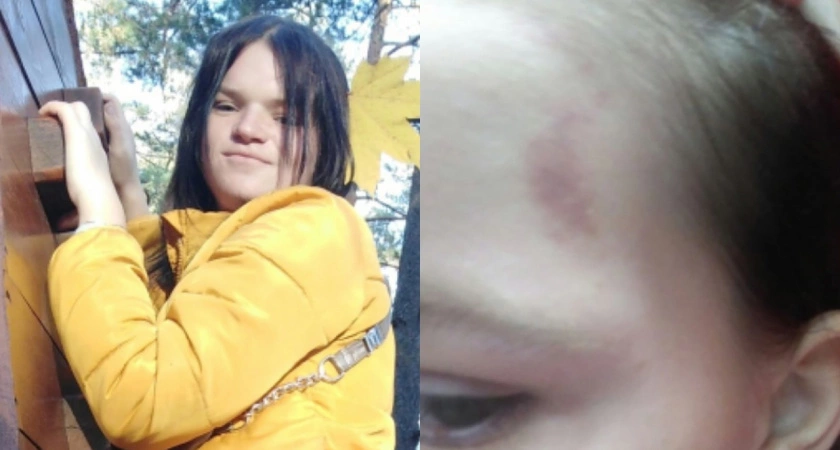 Фото к статье: «С ноги в живот ударила, потом в грудь»: в Коврове избили девушку и сняли на видео