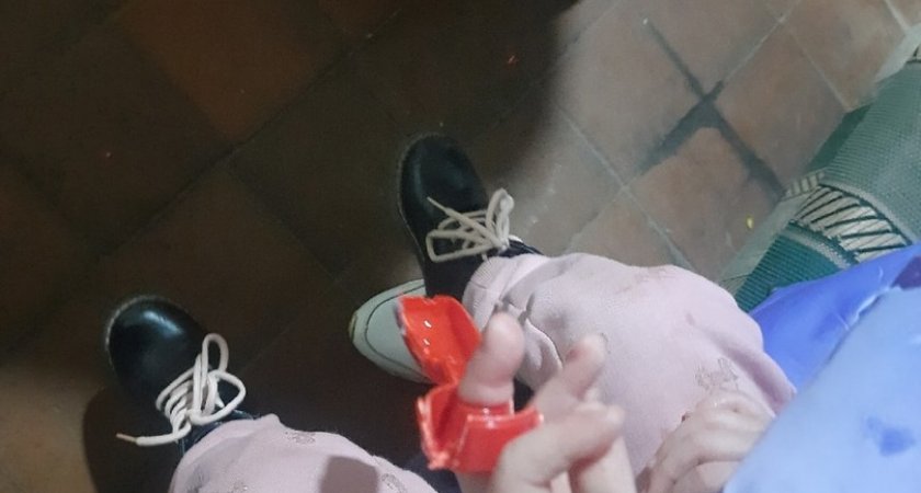 В Коврове 4-летняя девочка застряла пальцем в пластиковой игрушке