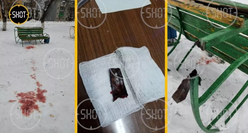 Фото к статье: Участник СВО спас жизнь ковровчанки, пострадавшей от взрыва петарды