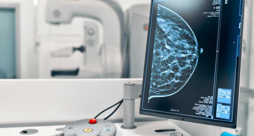 «Ростелеком» вывел маммографию во Владимирской области на новый уровень