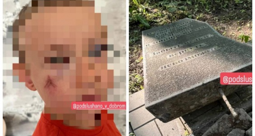 Во Владимире на 6-летнего мальчика рухнула плита памятника 