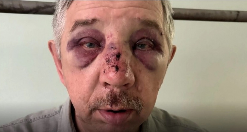 Во Владимирской области подростков осудили за жестокое избиение пенсионера