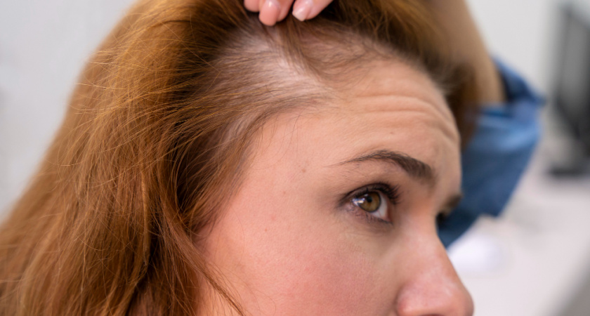 Этот цвет волос может сильно старить: какой оттенок выбрать вместо него - ответ стилиста