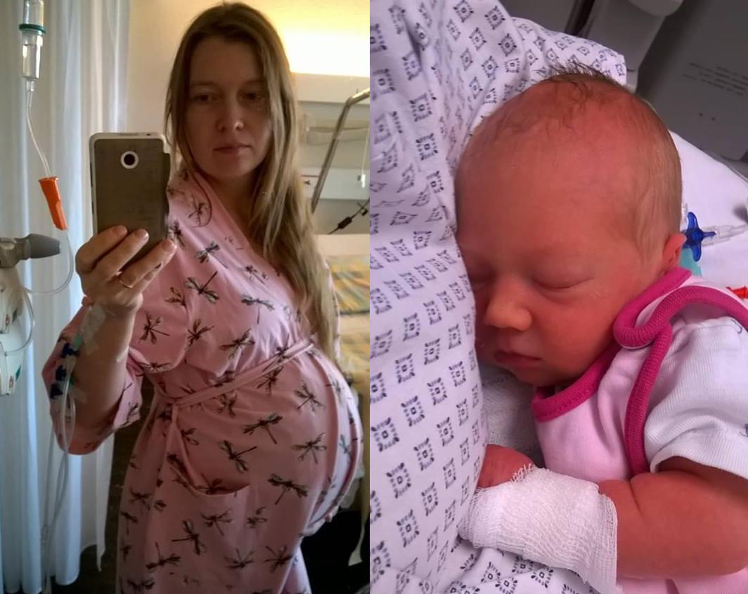 Жительница Владимира  родила здоровую девочку после внутриутробной операции