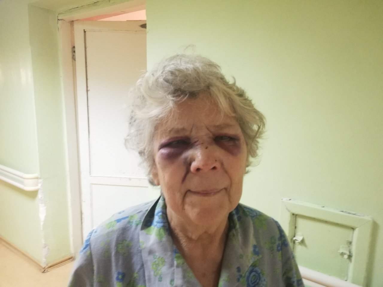 Избитая бабушка: "Он схватил серый камень и начал бить меня по лицу"