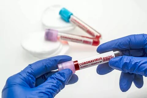 Владимирцы смогут бесплатно пройти тестирование на коронавирус