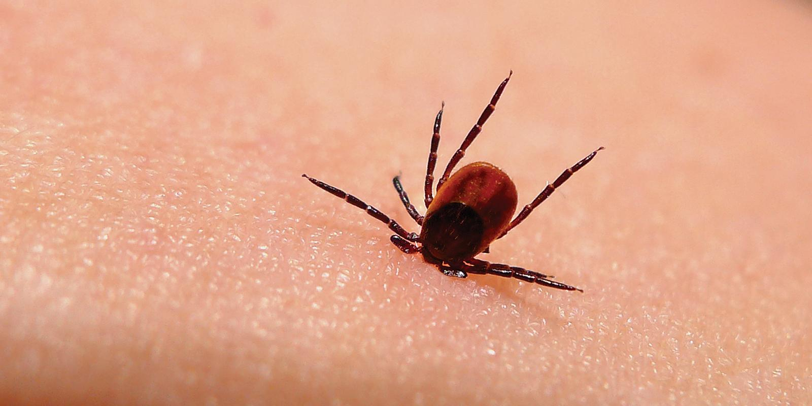 Житель Владимирской области заразился энцефалитом