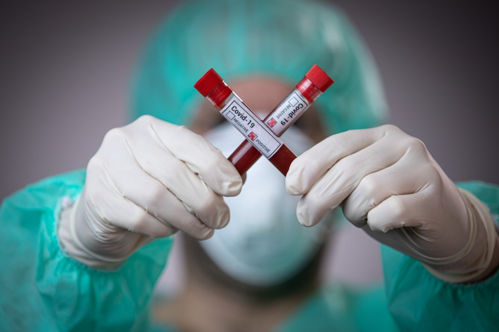 Во Владимирской области провели более 13 тысяч тестов на коронавирус