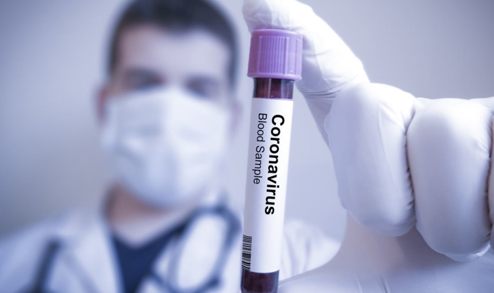 Больше 600 жителей Владимирской области заражены коронавирусом