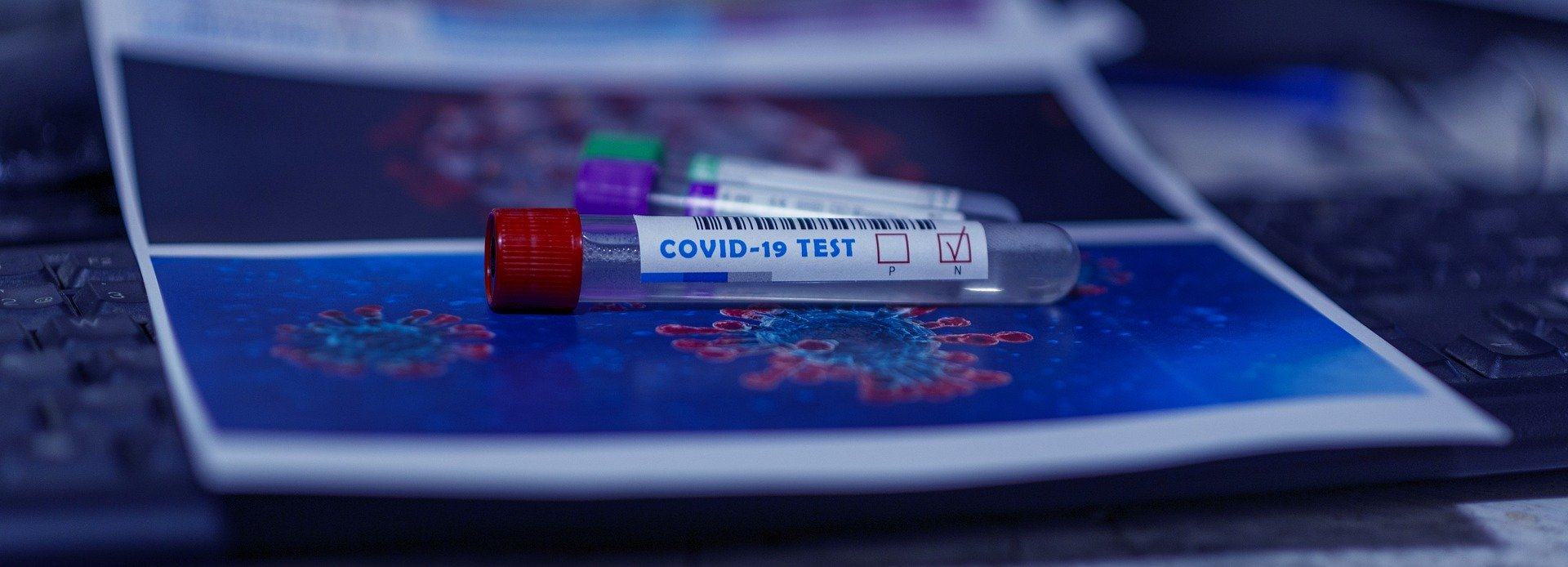 Во Владимирской области подтверждено 57 новых случаев коронавируса