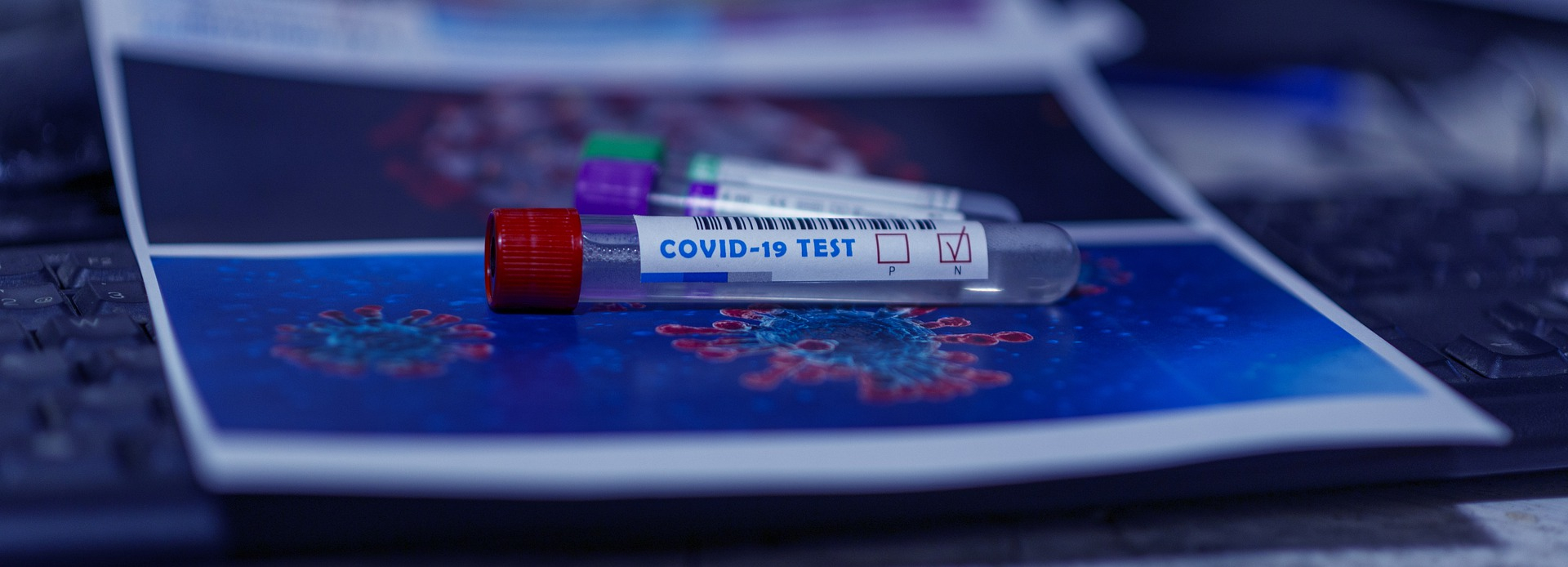 В 33 регионе выявили еще 54 новых случая коронавируса