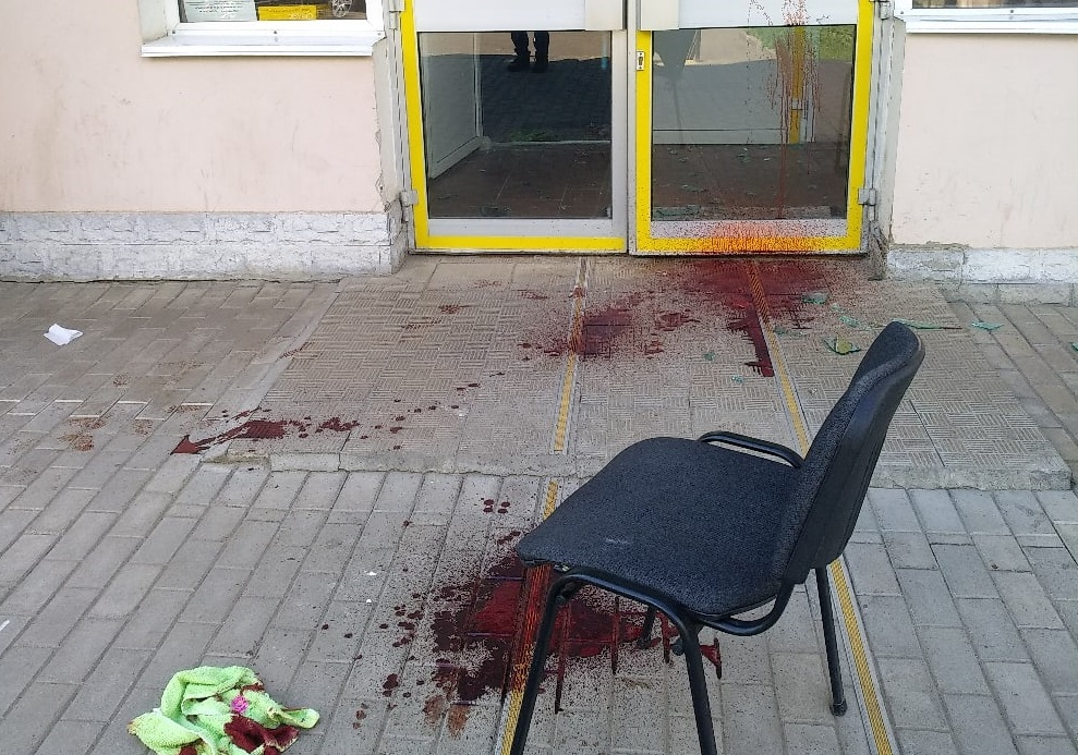 Жители Владимира обнаружили лужи крови возле центра занятости