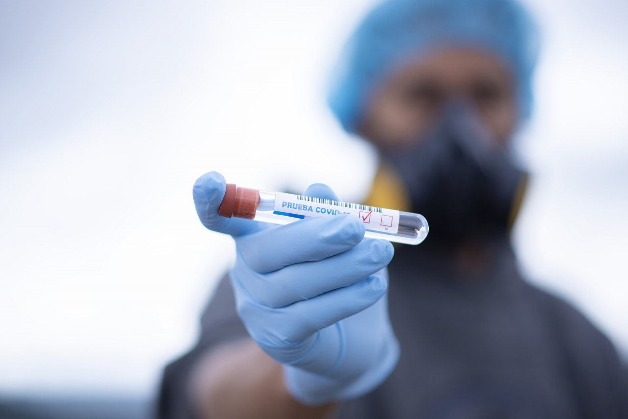 Еще 27 человек заразились коронавирусом во Владимирской области