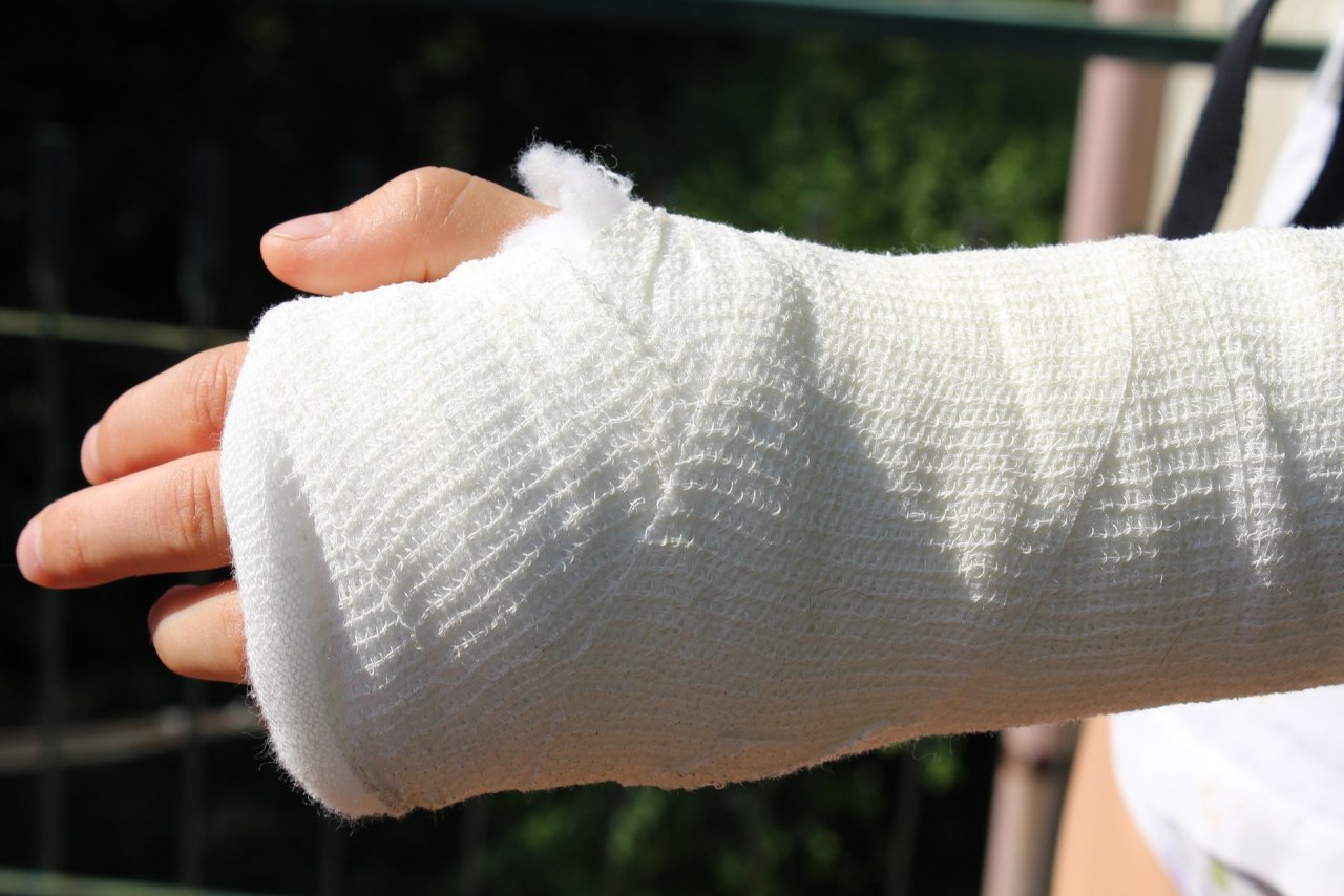В Коврове ребенок сломал руку в семейном развлекательном центре