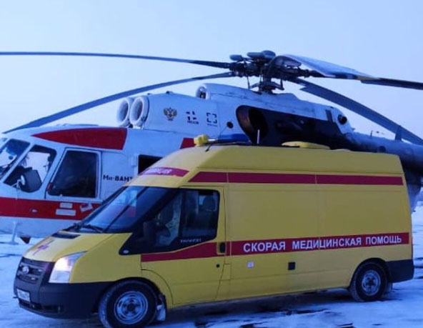 Владимирский рабочий-сантехник получил ожоги 80% тела