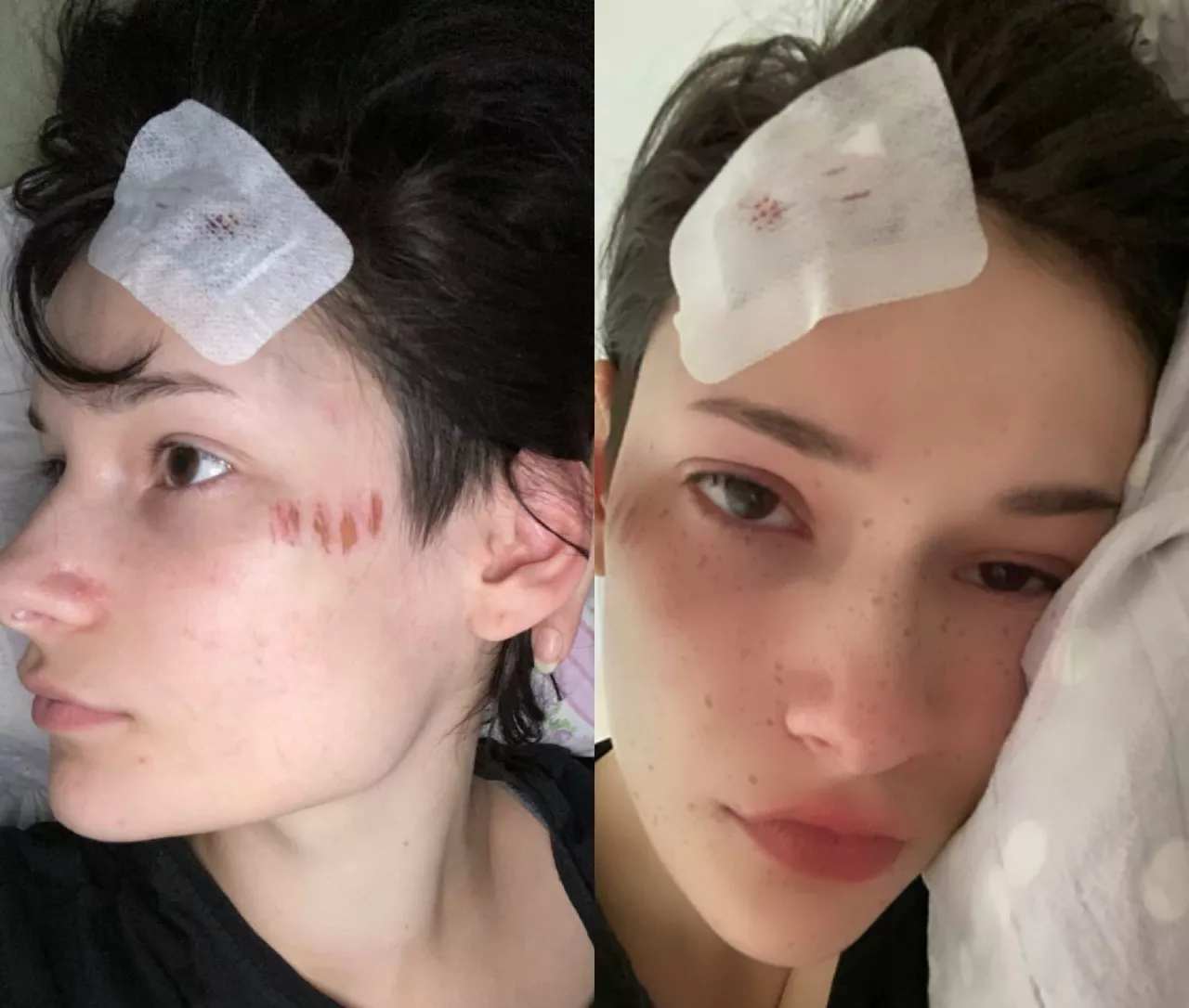 Фото к статье: Сбитая девушка-пешеход у центра ИЗО: "Как я вообще не умерла?"