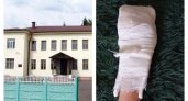 Во Владимирской области по недосмотру педагога у ребёнка-инвалида теперь искалечена рука