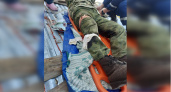 В Коврове мужчина разрезал свою ногу болгаркой 