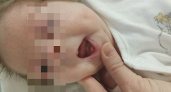 Во Владимире родился ребенок с первородными зубками