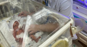 С начала года в ОПЦ родились двое мальчиков с весом менее 1,5 кг
