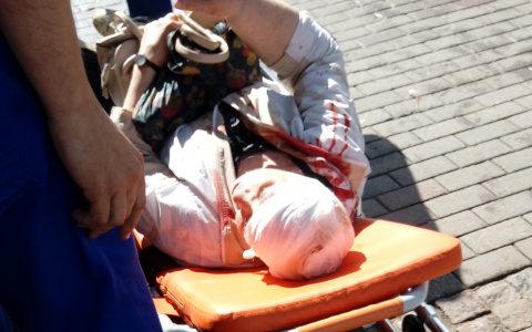 В центре Владимира машина сбила женщину, идущую по тротуару