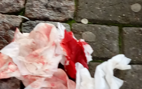 В Гусь-Хрустальном мужчина несколько раз ударилом ножом в живот соседку