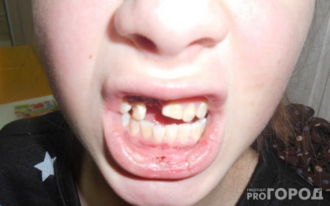 Школьницы из Александрова, жестоко избившие ровесницу, заплатят 11 000 руб