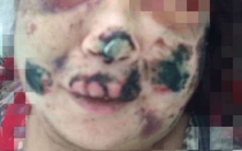 Новости России: Маньяк четыре часа пытал женщину, откусив ей нос и уши (фото)