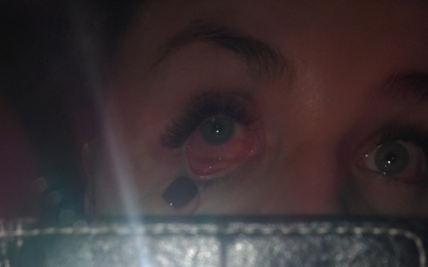 Молодая мама получила ожоги глаз во владимирском салоне красоты