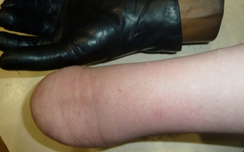 Новости России: охранники магазина унизили девушку без рук, обвинив ее в краже перчаток