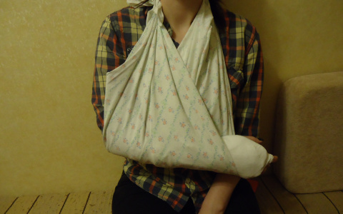 Из-за плохого покрытия девушка повредила руку на катке в центре Владимира