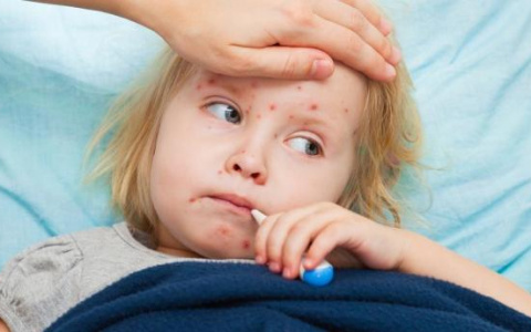 Уровень заболеваемости корью во Владимире стабилизировался