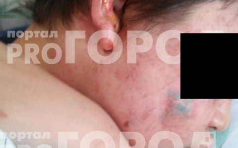 Мама избитого Кирилла: "Не надо устраивать самосуд"