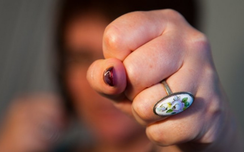 30-летняя жительница Кольчугино напала на пенсионера и расцарапала лицо