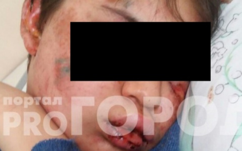 Школьник, которого подростки избили в Покрове, идет на поправку