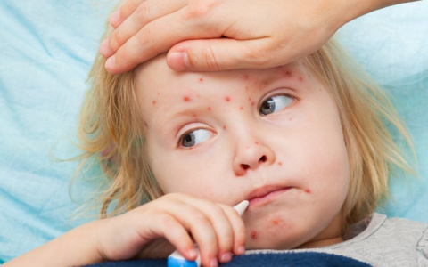Малыш из Москвы стал причиной эпидемии кори во Владимире?