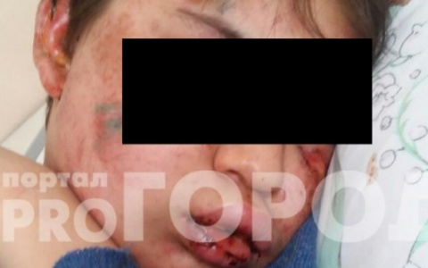 Прокуратура выяснила новые детали дела об избиении покровского школьника