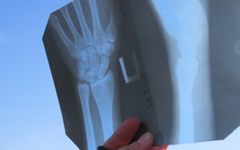 В Меленковской центральной районной больнице обновлен рентген-кабинет