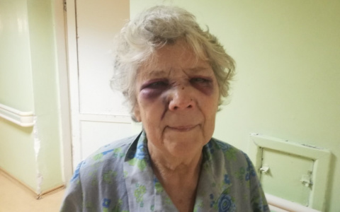 Избитая бабушка: "Он схватил серый камень и начал бить меня по лицу"