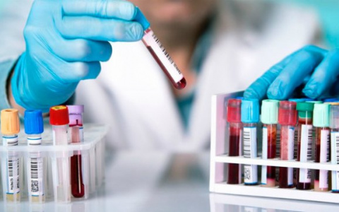 Хламидиоз: почему не нужно бояться сдавать анализы на эту болезнь