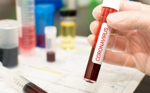 Врачи выяснили, чем заболели два китайца в Судогде