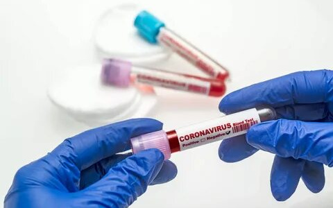 Владимирцы смогут бесплатно пройти тестирование на коронавирус