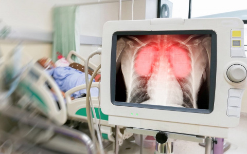 Во Владимирской области подтверждена первая смерть больного с коронавирусом