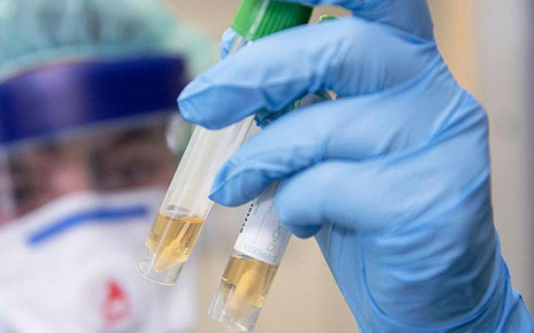 В 33 регионе зарегистрировали еще 60 случаев заболевания коронавирусом