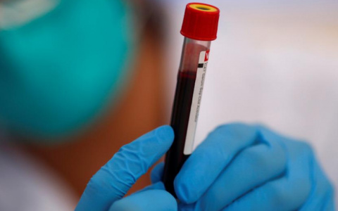 За сутки во Владимирской области выявили еще 44 случая коронавируса